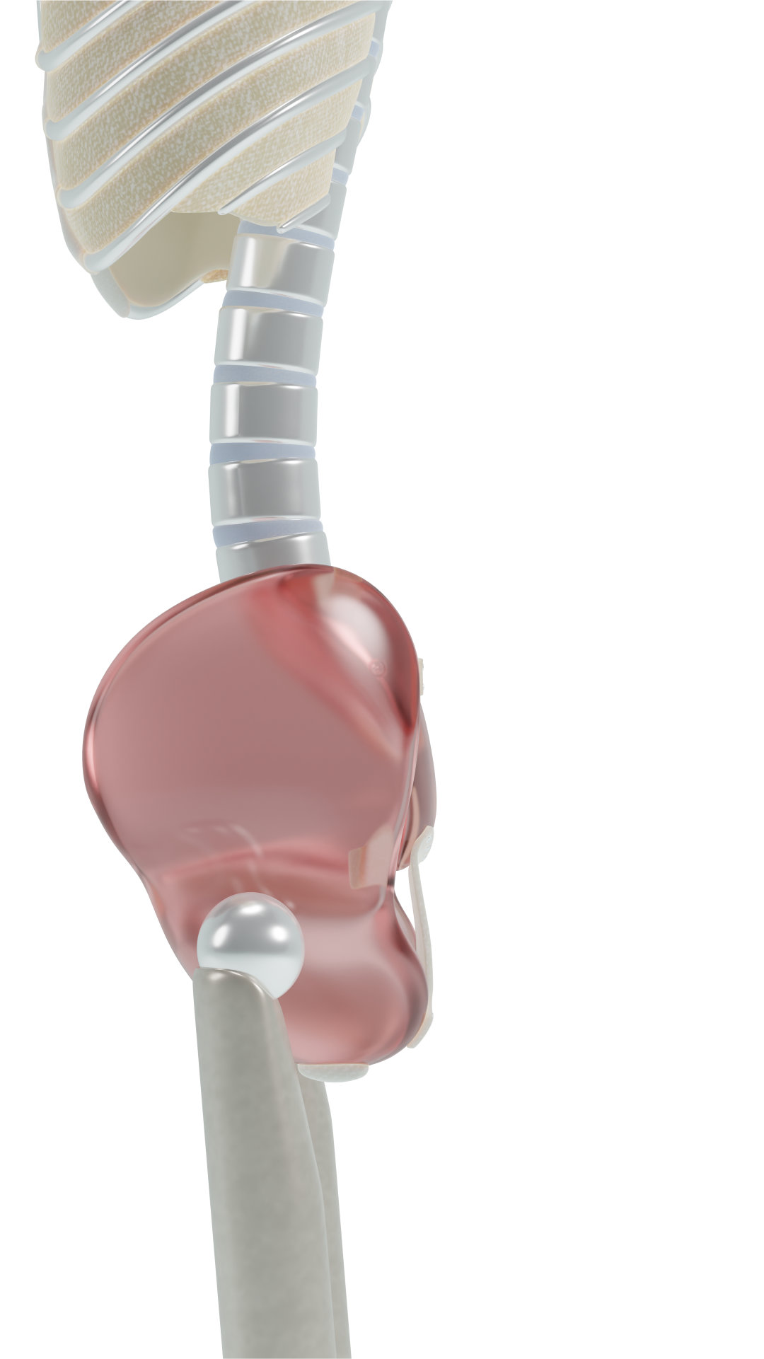 Forward shift Anterior pelvic shift